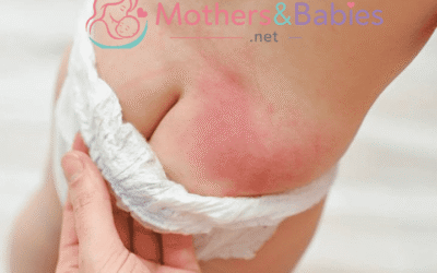Best Diaper Rash Cure in 2026: Top-Rated Creams That Work Fast